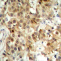 NF-kappaB p65 Rabbit Polyclonal Antibody