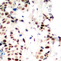 RPA2 (Phospho-T21) Antibody