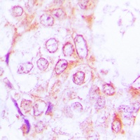 RSK1/2/3 (Phospho-T573/570/577) Antibody