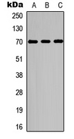 S6K1 (Phospho-T229) Antibody