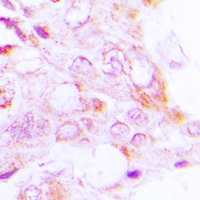 S6K1 (Phospho-T229) Antibody