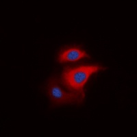 S6K1 (Phospho-T229) Antibody