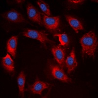 S6K1 (Phospho-T412) Antibody