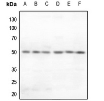Secretin Receptor Rabbit Polyclonal Antibody