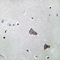 Secretin Receptor Rabbit Polyclonal Antibody