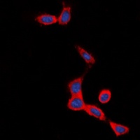 Secretin Receptor Rabbit Polyclonal Antibody