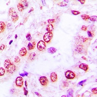 SKIL Rabbit Polyclonal Antibody