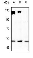SNAT2 Rabbit Polyclonal Antibody