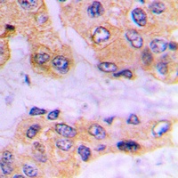 SMAD3 (Phospho-S213) Antibody