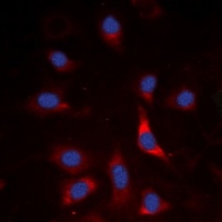 SMAD3 (Phospho-S213) Antibody