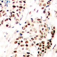 SNAI1 (Phospho-S246) Antibody
