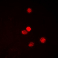 SNAI1 (Phospho-S246) Antibody