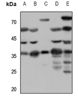 SSTR1 Rabbit Polyclonal Antibody