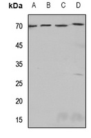 SSTR4 Rabbit Polyclonal Antibody