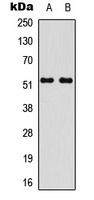 STEAP4 Rabbit Polyclonal Antibody