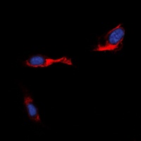 STEAP4 Rabbit Polyclonal Antibody