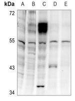 LKB1 (Phospho-T189) Rabbit Polyclonal Antibody