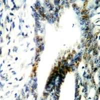LKB1 (Phospho-T189) Rabbit Polyclonal Antibody