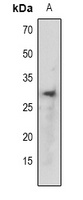 TCF6 Rabbit Polyclonal Antibody