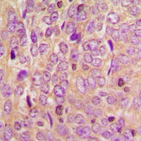 TCF6 Rabbit Polyclonal Antibody