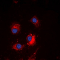 TCF6 Rabbit Polyclonal Antibody