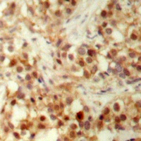 p53 (Phospho-S6) Antibody
