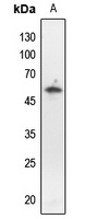 p53 (Phospho-T18) Rabbit Polyclonal Antibody