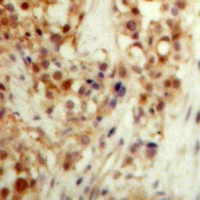p53 (Phospho-S20) Antibody