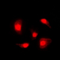p53 (Phospho-S20) Antibody