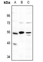 p53 Rabbit Polyclonal Antibody