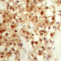 p53 Rabbit Polyclonal Antibody