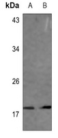 VAMP1/2/3 Rabbit Polyclonal Antibody