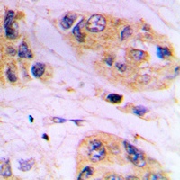 VAMP1/2/3 Rabbit Polyclonal Antibody