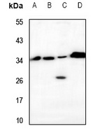 VTI1B Antibody
