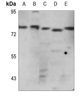 WASF1 Rabbit Polyclonal Antibody