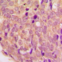 WASF1 Rabbit Polyclonal Antibody