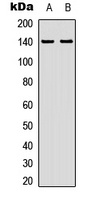 ZC3H4 Rabbit Polyclonal Antibody