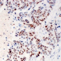 ZC3H4 Rabbit Polyclonal Antibody