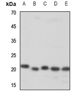 ZNF695 Rabbit Polyclonal Antibody