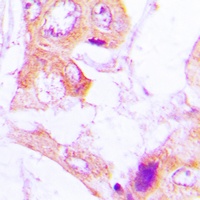 ACC alpha (Phospho-S80) Antibody