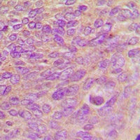 ARHGEF7 Rabbit Polyclonal Antibody