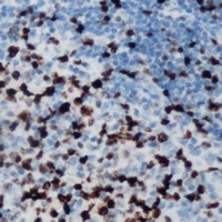 BCL6 Rabbit Polyclonal Antibody