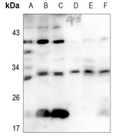CD69 Antibody