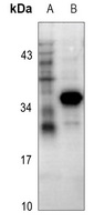 Cathepsin B Antibody