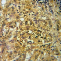 Cathepsin B Antibody