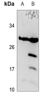 DHRS11 Rabbit Polyclonal Antibody