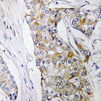 DHRS11 Rabbit Polyclonal Antibody