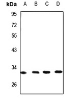 DHRS4 Rabbit Polyclonal Antibody