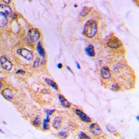 DHRS4 Rabbit Polyclonal Antibody