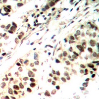 ELF1 Rabbit Polyclonal Antibody